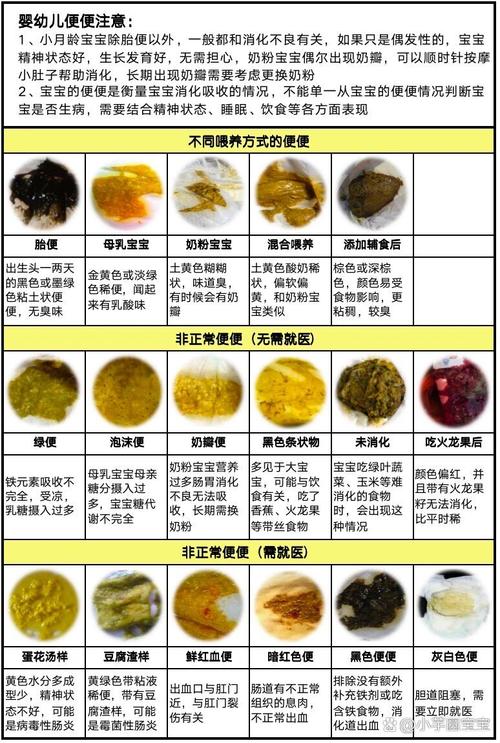 小孩大便颜色常识图解 - 小孩儿大便颜色 第4张 小孩大便颜色常识图解 - 小孩儿大便颜色 第4张