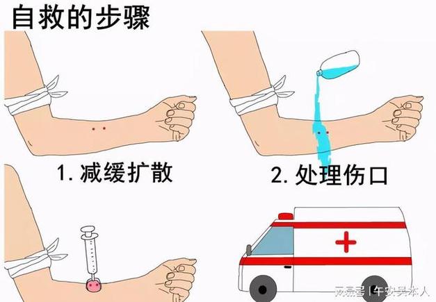 家庭急救小常识,家庭急救小常识手抄报 第5张 家庭急救小常识,家庭急救小常识手抄报 第5张